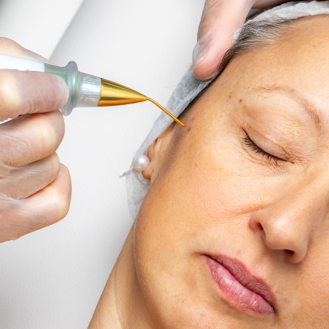 Plasma Fibroblast Masterclass