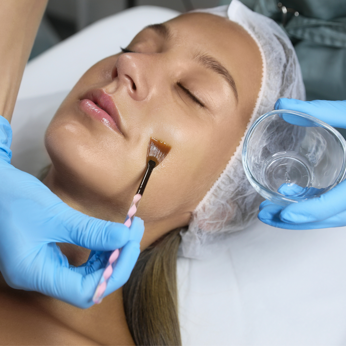 Superficial Peels Course - SHBBSKT011 - Provide Superficial Peel Treatments