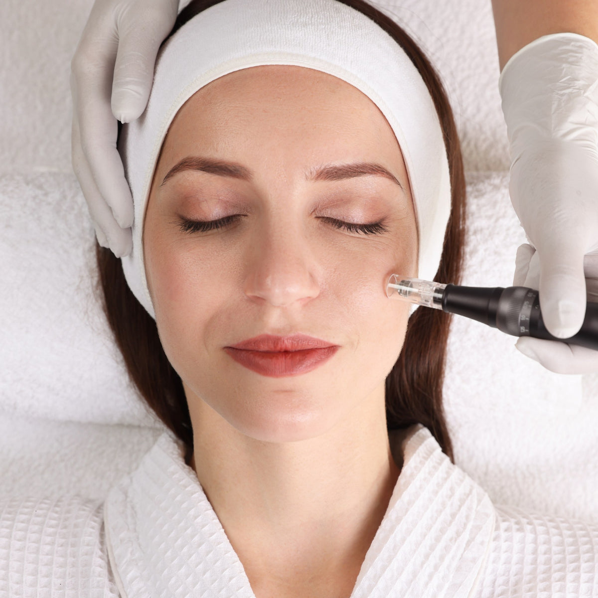 Skin needling pen treatment on a client's cheek - SHBBSKT010 skin needling training